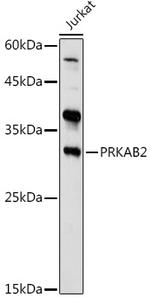 AMPK beta-2 Antibody in Western Blot (WB)