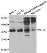 PYCR1 Polyclonal Antibody