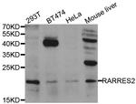 Chemerin Antibody in Western Blot (WB)