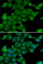 RASGRF1 Antibody in Immunocytochemistry (ICC/IF)
