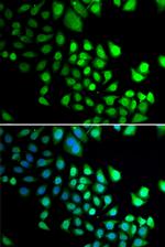 RBBP5 Polyclonal Antibody