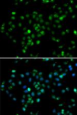 RBBP6 Antibody in Immunocytochemistry (ICC/IF)