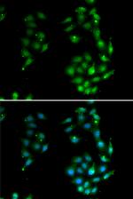 SOX5 Polyclonal Antibody