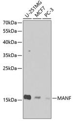 ARMET Antibody in Western Blot (WB)