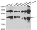 RDBP Antibody in Western Blot (WB)