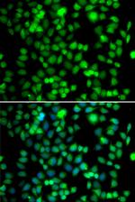 FKBP6 Polyclonal Antibody