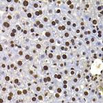 HIRIP3 Antibody in Immunohistochemistry (Paraffin) (IHC (P))
