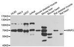 HIRIP3 Antibody in Western Blot (WB)