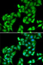 COPS3 Polyclonal Antibody