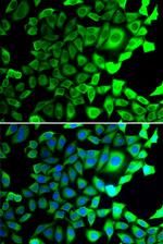 USP8 Antibody in Immunocytochemistry (ICC/IF)
