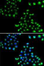 COPB2 Polyclonal Antibody