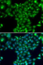 TGM5 Polyclonal Antibody