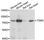 TGM5 Antibody in Western Blot (WB)