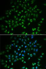 HAND2 Polyclonal Antibody