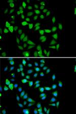 STAMBP Polyclonal Antibody