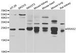 RRAS2 Polyclonal Antibody