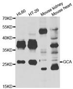 Grancalcin Antibody in Western Blot (WB)