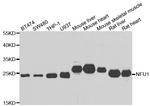 NFU1 Polyclonal Antibody