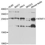 NTMT1 Antibody in Western Blot (WB)
