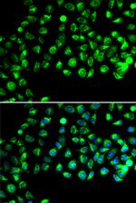 GTL3 Polyclonal Antibody