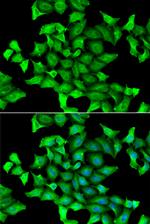 SLA/LP Polyclonal Antibody
