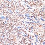 NAA20 Polyclonal Antibody