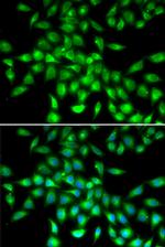 SERPINA10 Polyclonal Antibody