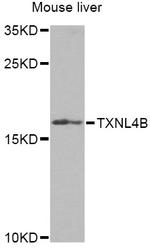 TXNL4B Antibody in Western Blot (WB)