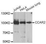 DBC1 Antibody in Western Blot (WB)