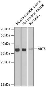 ART5 Polyclonal Antibody