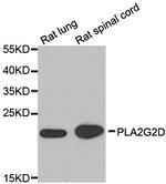 PLA2G2D Antibody in Western Blot (WB)
