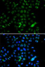 ELF4 Polyclonal Antibody