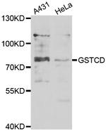 GSTCD Antibody in Western Blot (WB)