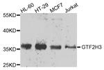 GTF2H3 Polyclonal Antibody