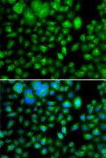 METTL7B Antibody in Immunocytochemistry (ICC/IF)