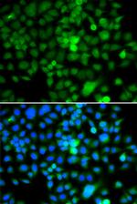 NAP1L3 Polyclonal Antibody