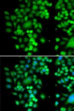 PHYHD1 Polyclonal Antibody