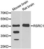 RSRC1 Antibody in Western Blot (WB)