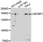 SETBP1 Antibody in Western Blot (WB)