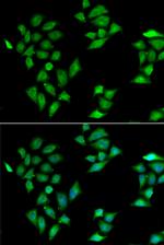 ITLN1 Antibody in Immunocytochemistry (ICC/IF)
