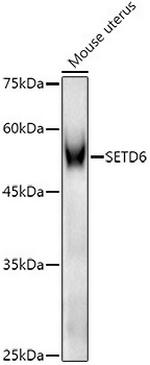 SETD6 Polyclonal Antibody