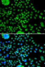 ATOH7 Polyclonal Antibody