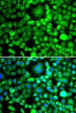BLID Antibody in Immunocytochemistry (ICC/IF)