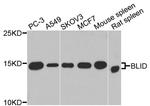 BLID Antibody in Western Blot (WB)
