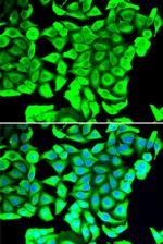DCD Polyclonal Antibody