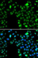 ING5 Polyclonal Antibody