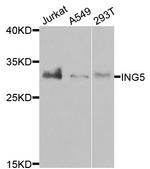 ING5 Antibody in Western Blot (WB)