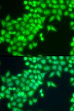 METTL2 Antibody in Immunocytochemistry (ICC/IF)