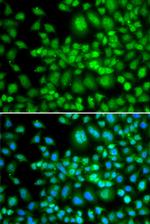 SETD5 Polyclonal Antibody