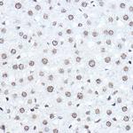 SETD5 Antibody in Immunohistochemistry (Paraffin) (IHC (P))